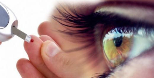 Diyabet ve Göz Arasındaki İlişki Nasıldır?