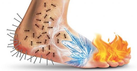 Nöropatik Diyabet Belirtileri ve Tedavisi